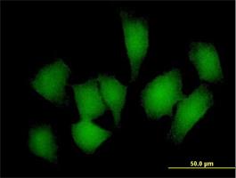 Immunocytochemistry/Immunofluorescence: REM1 Antibody [H00028954-B01] - Immunofluorescence of purified MaxPab antibody to REM1 on HeLa cell. [antibody concentration 10 ug/ml]