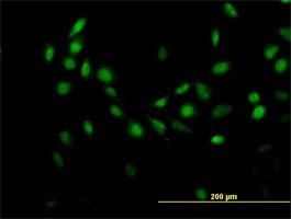 Immunocytochemistry/Immunofluorescence: G-substrate Antibody [H00010842-B01] - Immunofluorescence of purified MaxPab antibody to C7orf16 (Cat# H00010842-B01) on HeLa cell . [antibody concentration 10 ug/ml]