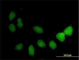 Immunocytochemistry/Immunofluorescence: TSPYL4 Antibody [H00023270-B01] - Immunofluorescence of purified MaxPab antibody to TSPYL4 on HeLa cell. [antibody concentration 10 ug/ml]