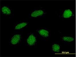 Immunocytochemistry/Immunofluorescence: GLI4 Antibody [H00002738-B01] - Immunofluorescence of purified MaxPab antibody to GLI4 on HeLa cell. [antibody concentration 10 ug/ml]