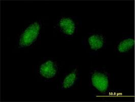 Immunocytochemistry/Immunofluorescence: TRIM45 Antibody [H00080263-B01] - Immunofluorescence of purified MaxPab antibody to TRIM45 on HeLa cell. [antibody concentration 10 ug/ml]
