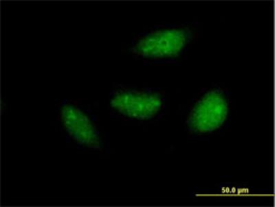 Immunocytochemistry/Immunofluorescence: NOL6 Antibody [H00065083-B01P] - Immunofluorescence of purified MaxPab antibody to NOL6 on HeLa cell. [antibody concentration 10 ug/ml]