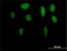 Immunocytochemistry/Immunofluorescence: ZFP95 Antibody [H00023660-B01] - ZFP95 ( Cat# H00023660-B01 ) on HeLa cell . [antibody concentration 10 ug/ml]