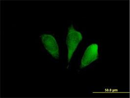 Immunocytochemistry/Immunofluorescence: FBX09 Antibody [H00026268-B01] - Immunofluorescence of purified MaxPab antibody to FBXO9 on HeLa cell. [antibody concentration 10 ug/ml]