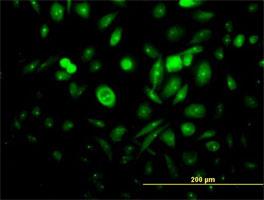 Immunocytochemistry/Immunofluorescence: FGFR1OP Antibody [H00011116-B01] - Immunofluorescence of purified MaxPab antibody to FGFR1OP on HeLa cell. [antibody concentration 10 ug/ml]