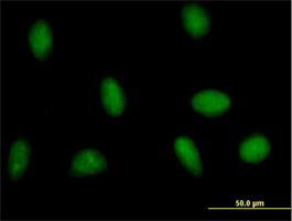 Immunocytochemistry/Immunofluorescence: HSFY1 Antibody [H00086614-B01] - Immunofluorescence of purified MaxPab antibody to HSFY1 on HeLa cell. [antibody concentration 10 ug/ml]