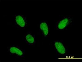 Immunocytochemistry/Immunofluorescence: PHF22 Antibody [H00057117-B01] - Immunofluorescence of purified MaxPab antibody to INTS12 on HepG2 cell. [antibody concentration 10 ug/ml]