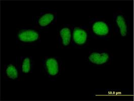 Immunocytochemistry/Immunofluorescence: NFATC2IP Antibody [H00084901-B01] - Immunofluorescence of purified MaxPab antibody to NFATC2IP on HeLa cell. [antibody concentration 10 ug/ml]