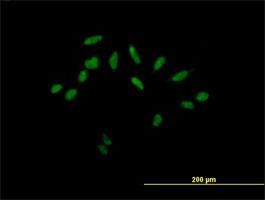 Immunocytochemistry/Immunofluorescence: DKFZp761H1710 Antibody [H00083459-B01] - Immunofluorescence of purified MaxPab antibody to DKFZP761H1710 on HeLa cell. [antibody concentration 10 ug/ml]