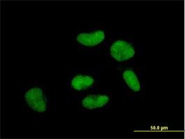 Immunocytochemistry/Immunofluorescence: RTF1 Antibody [H00023168-B01] - Immunofluorescence of purified MaxPab antibody to RTF1 on HeLa cell. [antibody concentration 10 ug/ml]