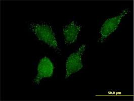 Immunocytochemistry/Immunofluorescence: HPCL Antibody [H00026061-B01] - Immunofluorescence of purified MaxPab antibody to PHYH2 on HeLa cell. [antibody concentration 10 ug/ml]