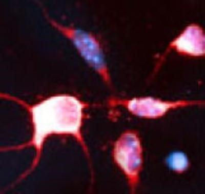 Immunocytochemistry/Immunofluorescence: RhoB Antibody [NB100-91274] - 1 day- old mouse cortical cell culture using Rabbit antibody to Rho-related GTP-binding protein RhoB: whole serum at 1:2000 dilution. DAPI counter stained.