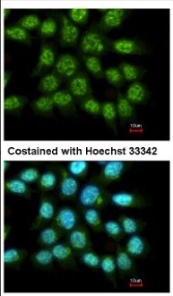 Immunocytochemistry/Immunofluorescence: FAM84A Antibody [NBP2-16424] - Immunofluorescence analysis of methanol-fixed A431, using antibody at 1:500 dilution.