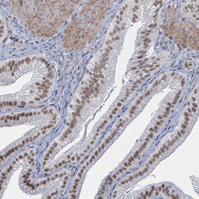 Immunohistochemistry-Paraffin: C1orf49 Antibody [NBP1-90529] Staining of human gall bladder shows strong nuclear positivity in glandular cells.
