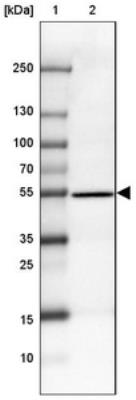 Western Blot: C2orf77 Antibody [NBP2-30925] - Lane 1: Marker [kDa] 250, 130, 100, 70, 55, 35, 25, 15, 10Lane 2: Liver