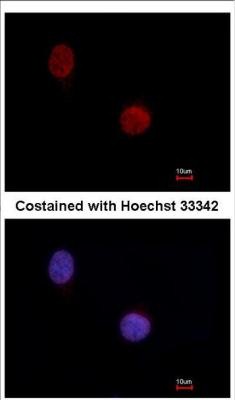 Immunocytochemistry/Immunofluorescence: BRCA2 Antibody (3E6) [NB600-445] - Analysis of paraformaldehyde-fixed HeLa, using BRCA2 antibody at 1:100 dilution.