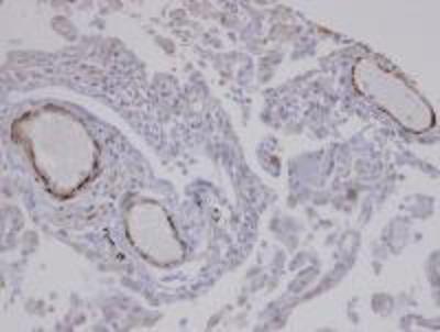 Immunohistochemistry: SENP7 Antibody [NBP1-31277] - Immunohistochemical analysis of paraffin-embedded Normal Lung blood vessel wall, using SENP7 antibody at 1:100 dilution.