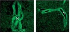 Immunocytochemistry/Immunofluorescence: TMTC1 Antibody [NBP1-21313] - Nervous Fiber (Left) and Vessel (Right)