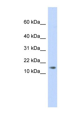 Western Blot: C11orf67 Antibody [NBP1-56786] - Human Placenta lysate, concentration 0.2-1 ug/ml.