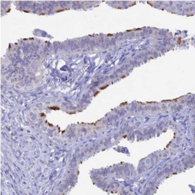 Immunohistochemistry: C2orf77 Antibody [NBP2-30925] - Immunohistochemical staining of human fallopian tube shows distinct positivity in cilia.
