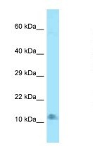 Western Blot: C7orf59 Antibody [NBP1-98263] - Titration: 1.0 ug/ml Positive Control: Mouse Heart.