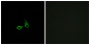 Immunocytochemistry/Immunofluorescence: EY Cadherin Antibody [NBP1-55784] - Analysis of HepG2 cells, using EY Cadherin Antibody. The picture on the right is treated with the synthesized peptide.