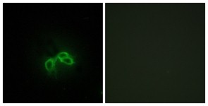 Immunocytochemistry/Immunofluorescence: BLCAP Antibody [NBP1-55612] - Analysis of NIH-3T3 cells, using BLCAP Antibody. The picture on the right is treated with the synthesized peptide.