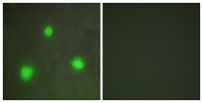 Immunocytochemistry/Immunofluorescence: FOXH1 Antibody [NBP1-55556] - Analysis of A549 cells, using FOXH1 Antibody. The picture on the right is treated with the synthesized peptide.