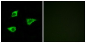 Immunocytochemistry/Immunofluorescence: Muscarinic Acetylcholine Receptor M4 Antibody [NBP1-70994] - Analysis of LOVO cells, using Muscarinic Acetylcholine Receptor M4 Antibody. The picture on the right is treated with the synthesized peptide.