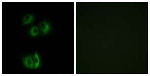 Immunocytochemistry/Immunofluorescence: Flamingo homolog 1 Antibody [NBP1-70926] - Analysis of A549 cells, using Flamingo homolog 1 Antibody. The picture on the right is treated with the synthesized peptide.