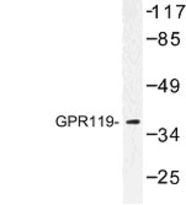 Western Blot: GPR119 Antibody [NBP1-00857] - Western blot (WB) analysis of GPR119 (V227) antibody in extracts from K562 cells.