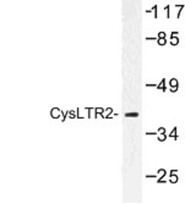 Western Blot: CysLTR2 Antibody [NBP1-00778] - Western blot (WB) analysis of CysLTR2 (K322) antibody in extracts from HeLa cells