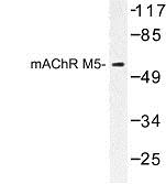 Western Blot: Muscarinic Acetylcholine Receptor M5 Antibody [NBP1-00907] - Western blot (WB) analysis of Muscarinic Acetylcholine Receptor M5 (L321) antibody in extracts from Jurkat cells