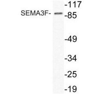 Western Blot: semaphorin-3F Antibody [NBP2-12981] - semaphorin-3F Analysis of SEMA3F (P783) pAb in extracts from HeLa cells