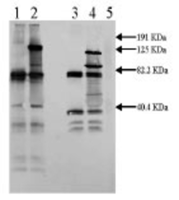 Western Blot: Tissue Plasminogen Activator Antibody [NB110-68110] - Rabbit anti Mouse tPA (2ug/ml)  Secondary: anti Rabbit IgG ABC Kit  Lane 1: 0.5ug mouse tPA (non-reduced)  Lane 2: 0.5ug mouse tPA + 3ug CPAI (non-reduced)  Lane 3: 0.5ug mouse tPA (reduced)  Lane 4: 0.5ug mouse tPA + 3ug CPAI (reduced)  Lane 5: Molecular weight standards