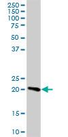 Western Blot: C9orf100 Antibody [H00084904-B02] - C9orf100 MaxPab polyclonal antibody (B02), Lot # 08087 WULz. Western Blot analysis of C9orf100 expression in human kidney.