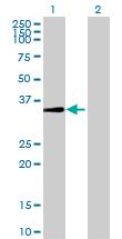 Western Blot: C9orf100 Antibody [H00084904-B02] - analysis of C9orf100 expression in transfected 293T cell line by C9orf100 MaxPab polyclonal antibody (B02). Lane 1: C9orf100 transfected lysate (38.30 KDa). Lane 2: Non-transfected lysate.