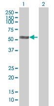 Western Blot: Coronin-2B Antibody [H00010391-B01] - analysis of CORO2B expression in transfected 293T cell line by CORO2B MaxPab polyclonal antibody (B01). Lane 1: CORO2B transfected lysate (54.40 KDa). Lane 2: Non-transfected lysate.