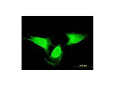 Immunofluorescence: IL25 Antibody (2D4) [H00056005-M03] - Immunogluorescence of H0005605-M03 on HeLa  cells (10ug/mL)