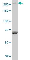Western Blot: BCOR Antibody [H00054880-A01] - BCOR polyclonal antibody (A01), Lot # 051214JC01 Western Blot analysis of BCOR expression in Y-79 ( Cat # L042V1 ).