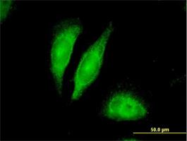 Immunocytochemistry/Immunofluorescence: ARHGDIG Antibody [H00000398-B01] - Immunofluorescence of purified MaxPab antibody to ARHGDIG (H00000398-B01) on HeLa cell . [antibody concentration 10 ug/ml]