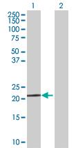 Western Blot: Proapoptotic Caspase Adaptor Protein Antibody [H00051237-B02] - analysis of PACAP expression in transfected 293T cell line by PACAP MaxPab polyclonal antibody (B02). Lane 1: PACAP transfected lysate (20.70 KDa). Lane 2: Non-transfected lysate.