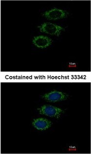 Immunocytochemistry/Immunofluorescence: PPIL1 Antibody [NBP2-15080] - Paraformaldehyde-fixed MCF-7, using antibody at 1:500 dilution.
