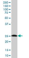Western Blot: C21orf33 Antibody [H00008209-A01] - C21orf33 polyclonal antibody (A01), Lot # 060717JCS1 Western Blot analysis of C21orf33 expression in K-562 ( Cat # L009V1 ).