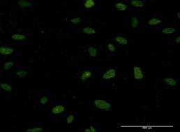 Immunocytochemistry/Immunofluorescence: NUCKS1 Antibody (3G10) [H00064710-M02] - on HeLa cell.