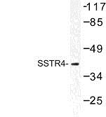 Western Blot: Somatostatin Receptor 4 Antibody [NBP1-01023] - Somatostatin Receptor 4 Antibody Western blot (WB) analysis of SSTR4 (Q194)  antibody in extracts from LOVO cells