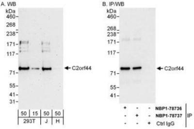 Western Blot: C2orf44 Antibody [NBP1-78737] - Whole cell lysate from 293T (15 and 50 mcg for WB; 1 mg for IP, 20% of IP loaded), Jurkat (J; 50 mcg) and HeLa (H; 50 mcg) cells.   Affinity purified rabbit anti-C2orf44 antibody  used for WB at 0.04 mcg/ml (A) and 0.4 mcg/ml (B) and used for IP at 6 mcg/mg lysate.  C2orf44 was also immunoprecipitated by rabbit anti-C2orf44 antibody NBP1-78736, which recognizes an upstream epitope.