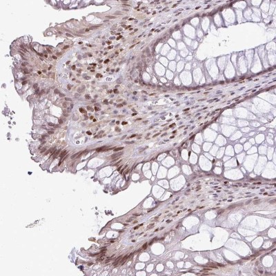 Immunohistochemistry: C1orf168 Antibody [NBP2-38743] - Staining of human rectum shows moderate nuclear positivity in glandular cells.