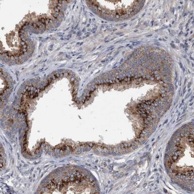 Immunohistochemistry: Protease Inhibitor 15 Antibody [NBP1-82444] - Staining of human prostate shows distinct cytoplasmic positivity in glandular cells.