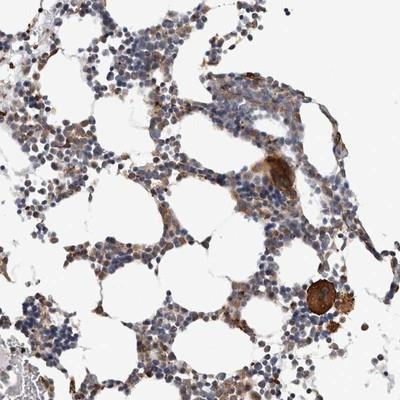 Immunohistochemistry: C7orf62 Antibody [NBP1-82726] - Staining of human bone marrow shows strong cytoplasmic positivity in megakaryocytes.